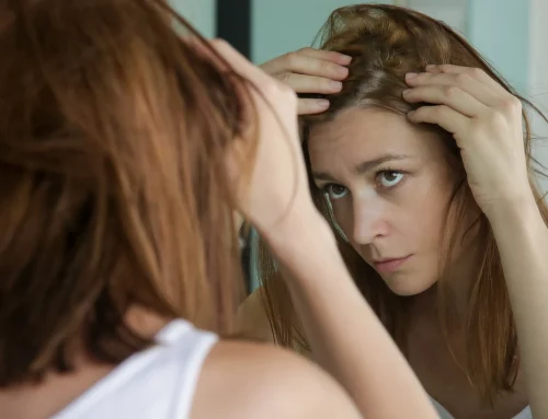 Hair Loss Isn’t “Just Hair” — And You Don’t Have to Navigate It Alone